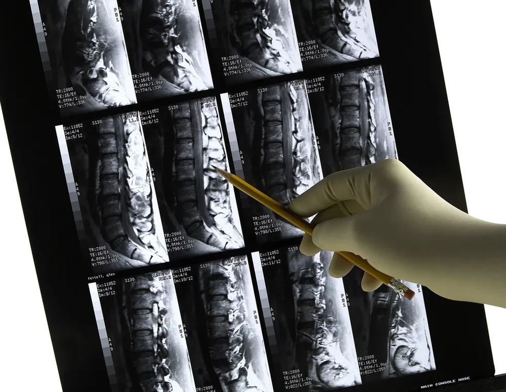 Exame de imagem da coluna vertebral